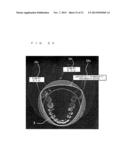 X-ray CT Photographic Apparatus diagram and image