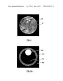 OPTIMIZED APERTURE SELECTION IMAGING COMPUTED TOMOGRAPHY SYSTEM AND METHOD diagram and image