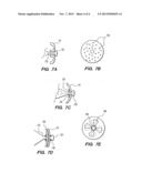 OPEN FIT CANAL HEARING DEVICE diagram and image