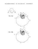 EARPHONE DEVICE diagram and image