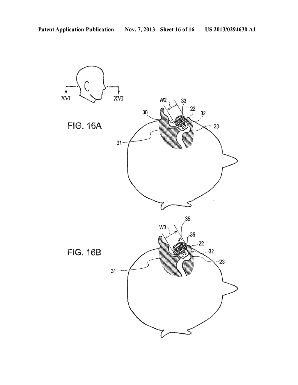 EARPHONE DEVICE - diagram, schematic, and image 17