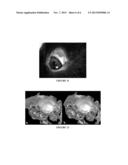 PHARMACOKINETIC DETERMINATION OF INTRAVITREAL AGENTS diagram and image