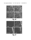 METHODS AND COMPOSITIONS FOR CNS DELIVERY OF B-GALACTOCEREBROSIDASE diagram and image