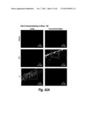 METHODS AND COMPOSITIONS FOR CNS DELIVERY OF B-GALACTOCEREBROSIDASE diagram and image