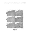 METHODS AND COMPOSITIONS FOR CNS DELIVERY OF B-GALACTOCEREBROSIDASE diagram and image