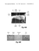 METHODS AND COMPOSITIONS FOR CNS DELIVERY OF B-GALACTOCEREBROSIDASE diagram and image