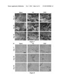 Polyurethane Composite for Wound Healing and Methods Thereof diagram and image