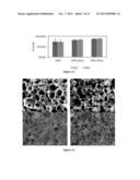 Polyurethane Composite for Wound Healing and Methods Thereof diagram and image