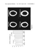 METHOD OF PROMOTING BONE GROWTH BY AN ANTI-ACTRIIA ANTIBODY diagram and image