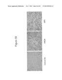 Frizzled-Binding Agents And Uses Thereof diagram and image