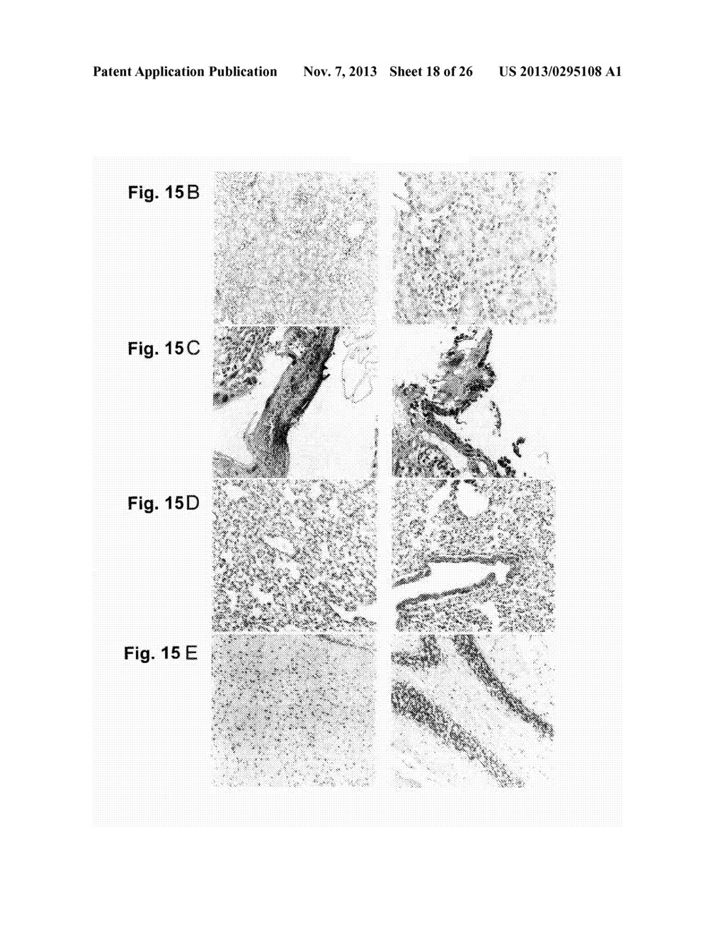 METHOD FOR TREATING SYNOVIAL SARCOMA - diagram, schematic, and image 19