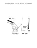 PROGENITOR ENDOTHELIAL CELL CAPTURING WITH A DRUG ELUTING IMPLANTABLE     MEDICAL DEVICE diagram and image