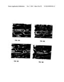 PROGENITOR ENDOTHELIAL CELL CAPTURING WITH A DRUG ELUTING IMPLANTABLE     MEDICAL DEVICE diagram and image