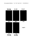 PROGENITOR ENDOTHELIAL CELL CAPTURING WITH A DRUG ELUTING IMPLANTABLE     MEDICAL DEVICE diagram and image