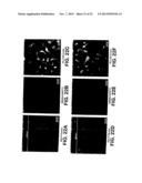 PROGENITOR ENDOTHELIAL CELL CAPTURING WITH A DRUG ELUTING IMPLANTABLE     MEDICAL DEVICE diagram and image