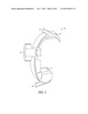 SPACER MOLDS FOR ORTHOPEDIC IMPLANTS diagram and image