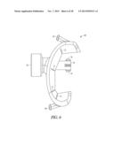 SPACER MOLDS FOR ORTHOPEDIC IMPLANTS diagram and image