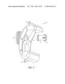 SPACER MOLDS FOR ORTHOPEDIC IMPLANTS diagram and image