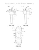 SPACER MOLDS FOR ORTHOPEDIC IMPLANTS diagram and image