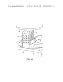 SPACER MOLDS FOR ORTHOPEDIC IMPLANTS diagram and image