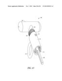 SPACER MOLDS FOR ORTHOPEDIC IMPLANTS diagram and image