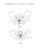 ORTHODONTIC APPARATUS diagram and image