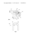 ORTHODONTIC APPARATUS diagram and image