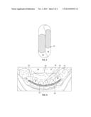 DEVICE AND METHOD FOR STABILIZATION OF TEETH diagram and image