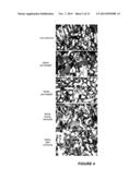 NGAL FOR DIAGNOSIS OF RENAL CONDITIONS diagram and image