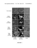 NGAL FOR DIAGNOSIS OF RENAL CONDITIONS diagram and image