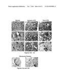 NGAL FOR DIAGNOSIS OF RENAL CONDITIONS diagram and image