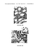 NGAL FOR DIAGNOSIS OF RENAL CONDITIONS diagram and image