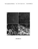 NGAL FOR DIAGNOSIS OF RENAL CONDITIONS diagram and image