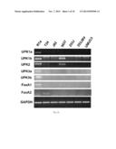 FOXA1 AS A MARKER FOR INVASIVE BLADDER CANCER diagram and image