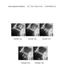 BIOMARKER ANAYLSIS USING SCODAPHORESIS diagram and image