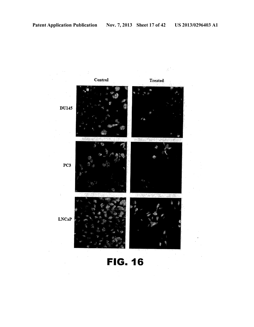 TARGETING EN2, PAX2, AND/OR DEFB1 FOR TREATMENT OF PROSTATE CONDITIONS - diagram, schematic, and image 18