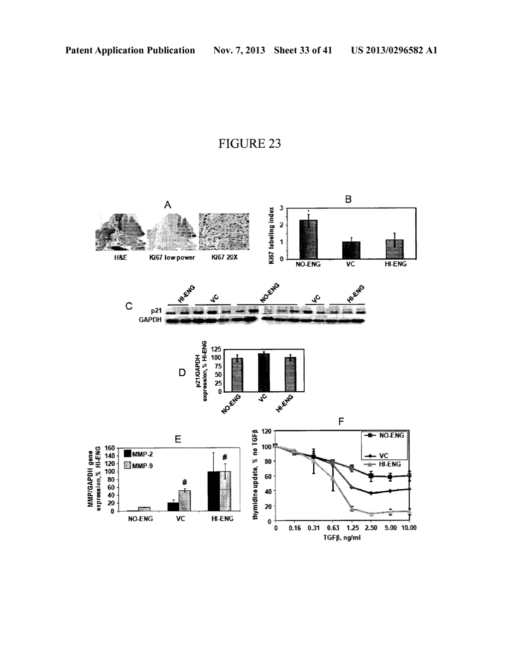 INHIBITION AND TREATMENT OF PROSTATE CANCER METASTASIS - diagram, schematic, and image 34