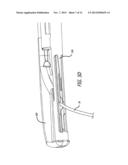 System for Delivering Anchors for Treating Incontinence diagram and image