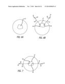 System for Delivering Anchors for Treating Incontinence diagram and image