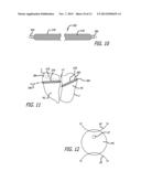 System for Delivering Anchors for Treating Incontinence diagram and image