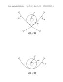 System for Delivering Anchors for Treating Incontinence diagram and image