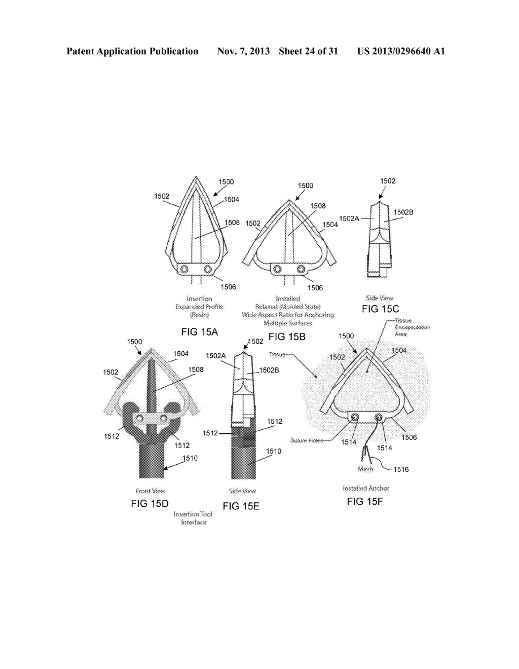 ATRAUMATIC MEDICAL DEVICE ANCHORING AND DELIVERY SYSTEM WITH ENHANCED     ANCHORING - diagram, schematic, and image 25