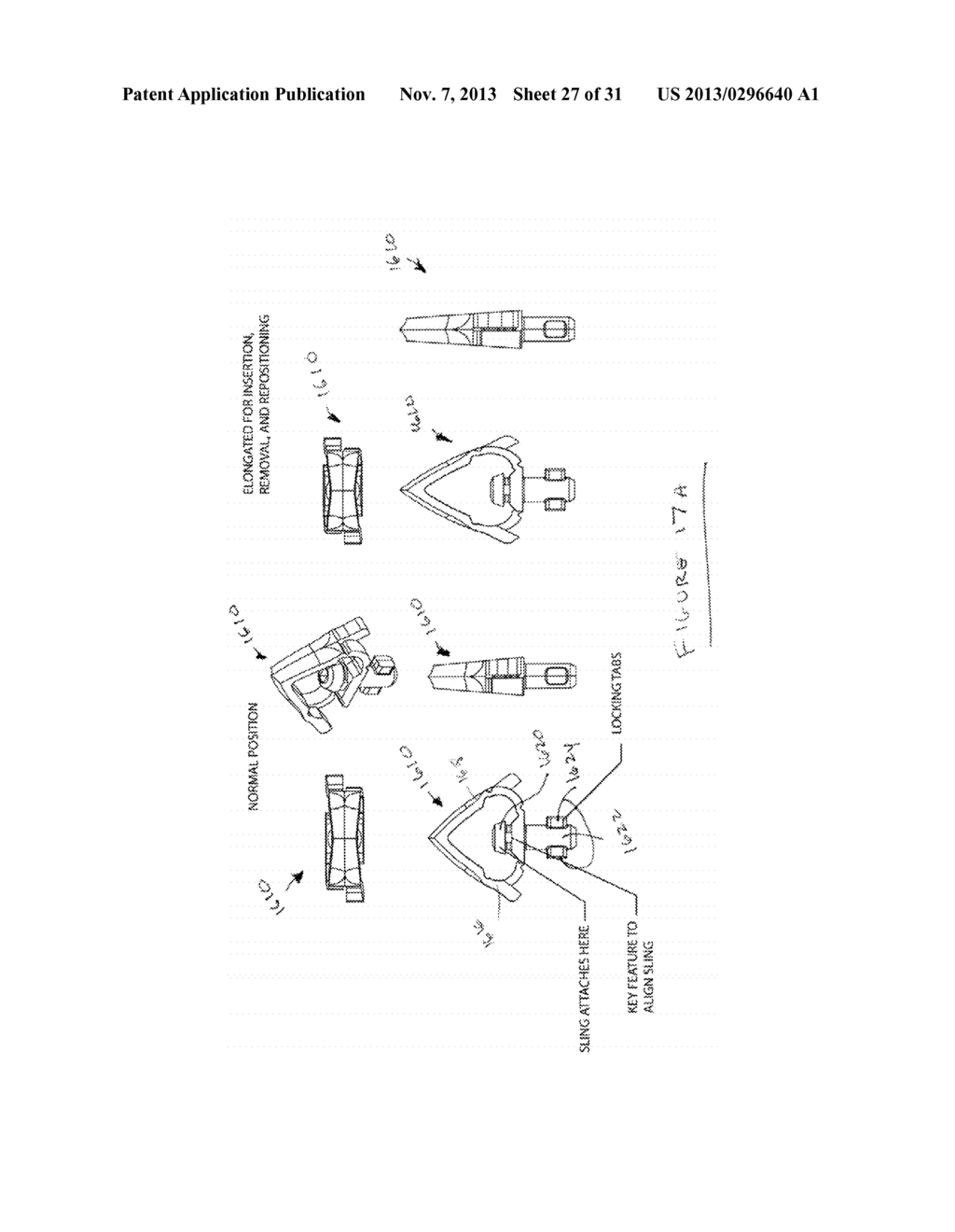 ATRAUMATIC MEDICAL DEVICE ANCHORING AND DELIVERY SYSTEM WITH ENHANCED     ANCHORING - diagram, schematic, and image 28