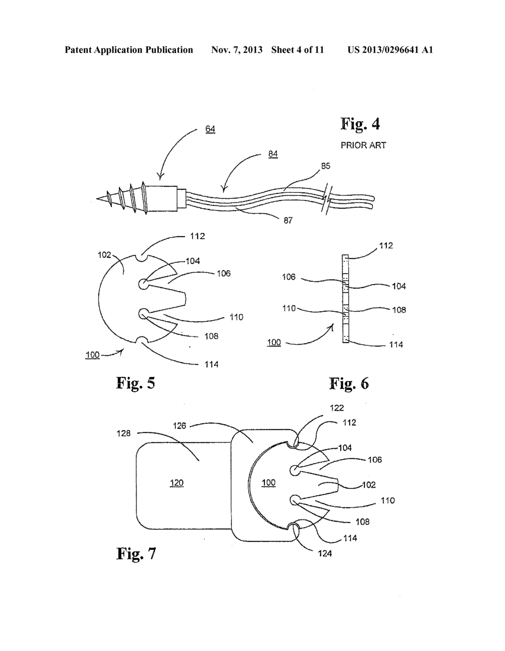 Method and Apparatus for Securing a Urethral Sling to Pubic Bone - diagram, schematic, and image 05