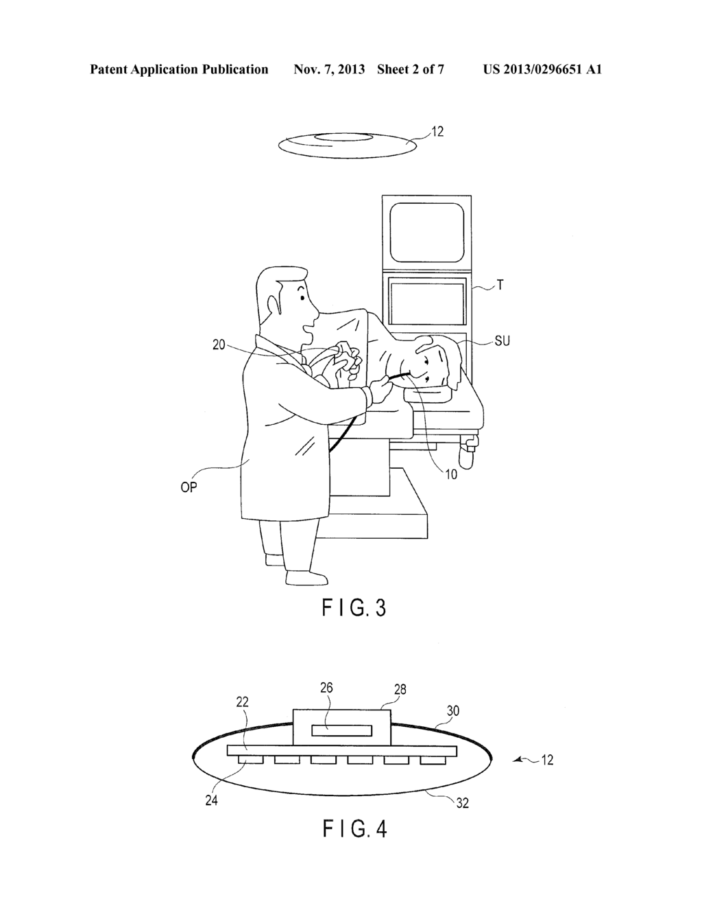 ENDOSCOPE SYSTEM - diagram, schematic, and image 03