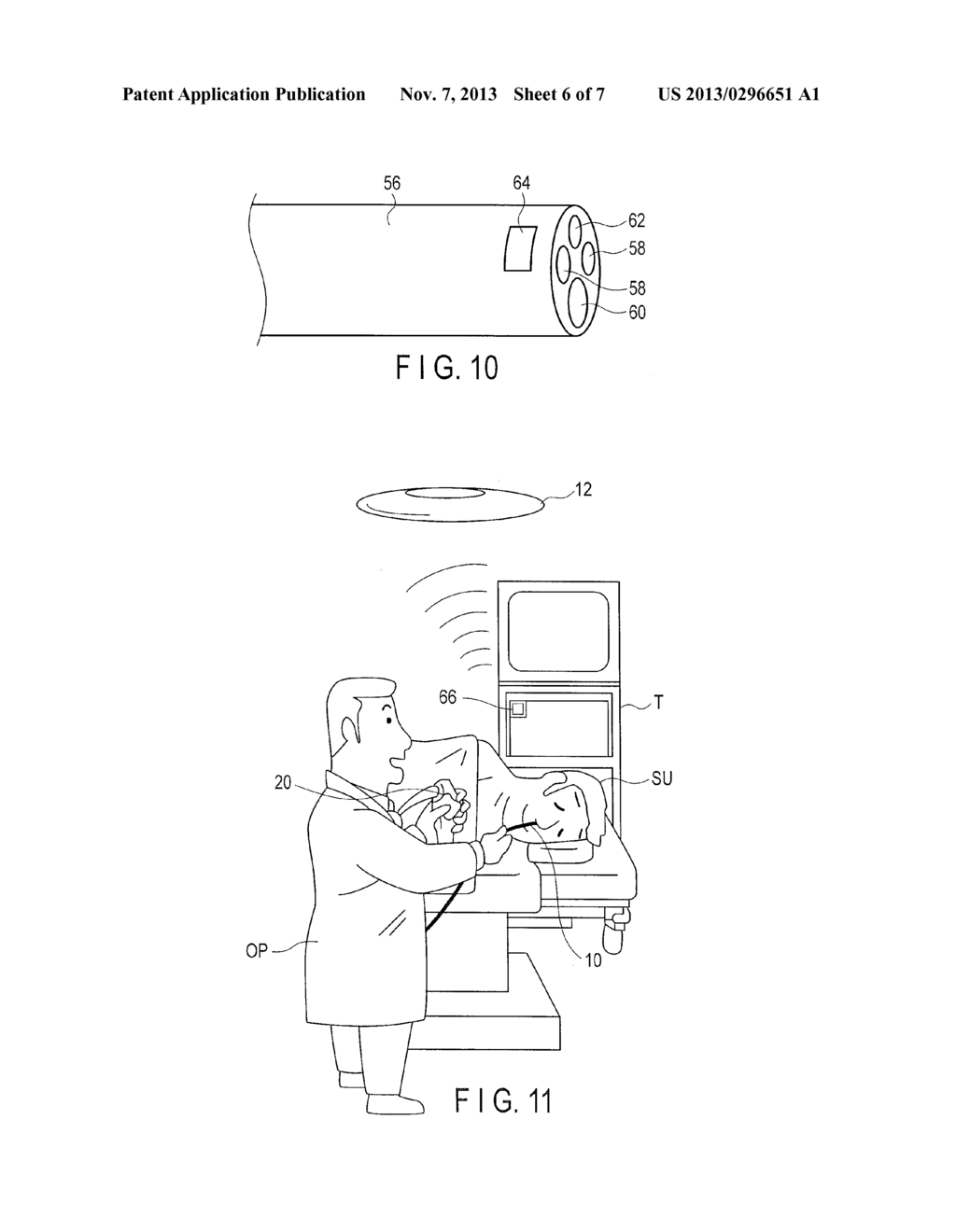 ENDOSCOPE SYSTEM - diagram, schematic, and image 07