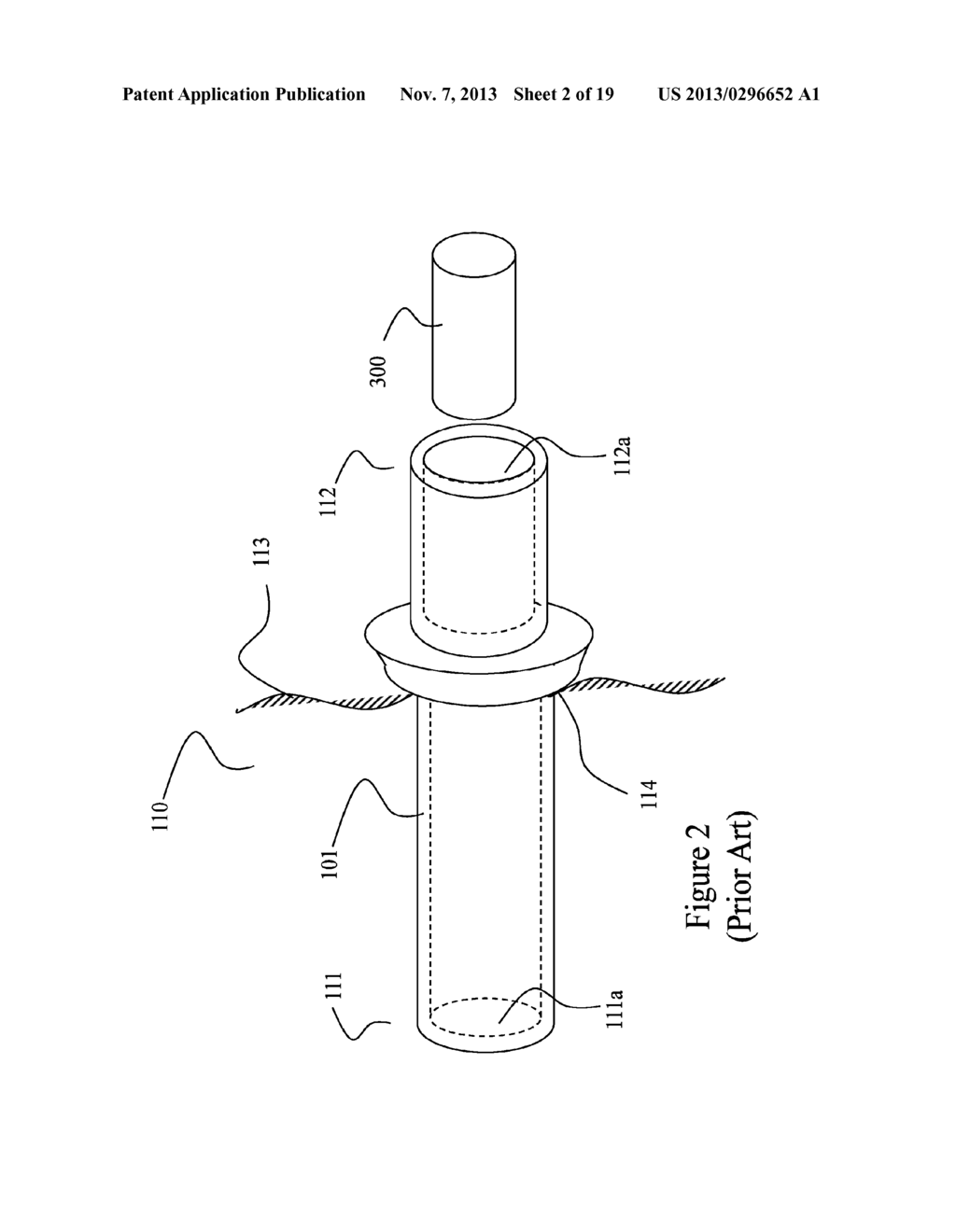 SOLID STATE ILLUMINATION FOR ENDOSCOPY - diagram, schematic, and image 03