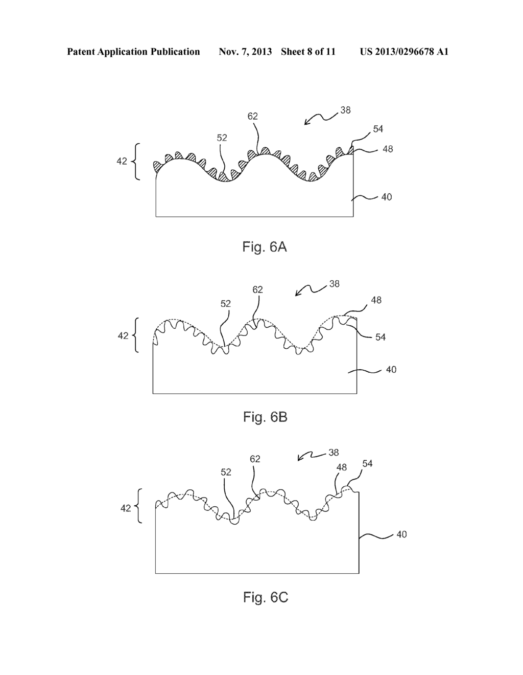 COMBINATION STRUCTURAL POROUS SURFACES FOR FUNCTIONAL ELECTRODE     STIMULATION AND SENSING - diagram, schematic, and image 09