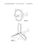 IMPEDANCE DETECTION OF VENOUS PLACEMENT OF MULTI-ELECTRODE CATHETERS diagram and image