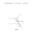 IMPEDANCE DETECTION OF VENOUS PLACEMENT OF MULTI-ELECTRODE CATHETERS diagram and image